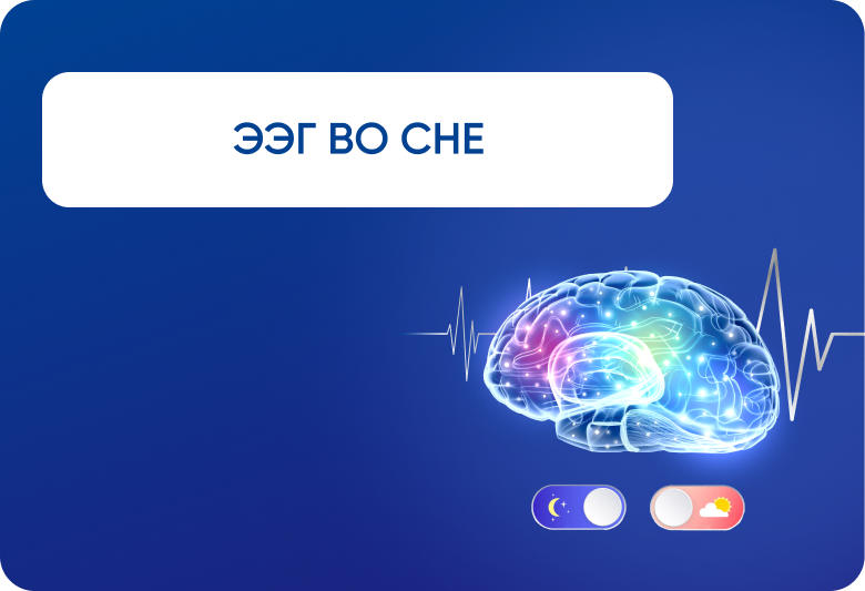 Видео-ЭЭГ мониторинг